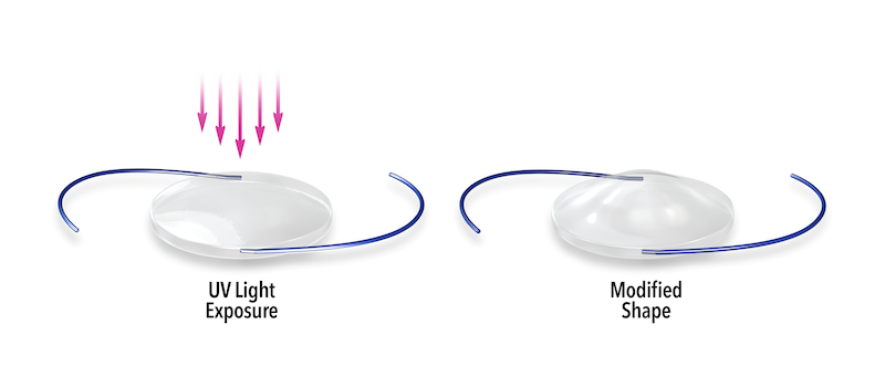 light adjustable lens diagram of how it works